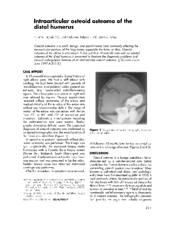 (PDF) Intraarticular osteoid osteoma of the distal humerus