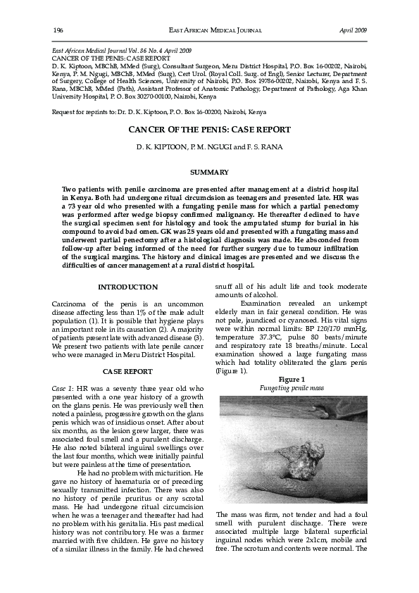 (PDF) Cancer Of The Penis: Case Report