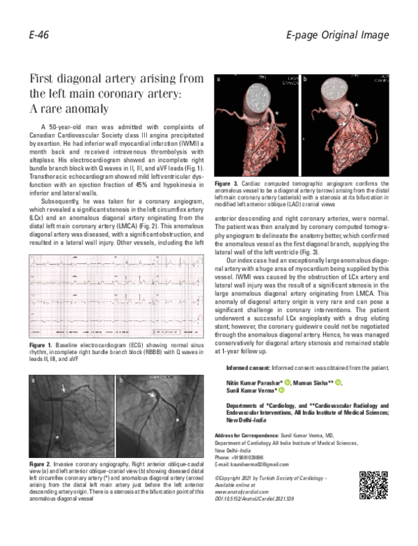 (PDF) First diagonal artery arising from the left main coronary artery ...