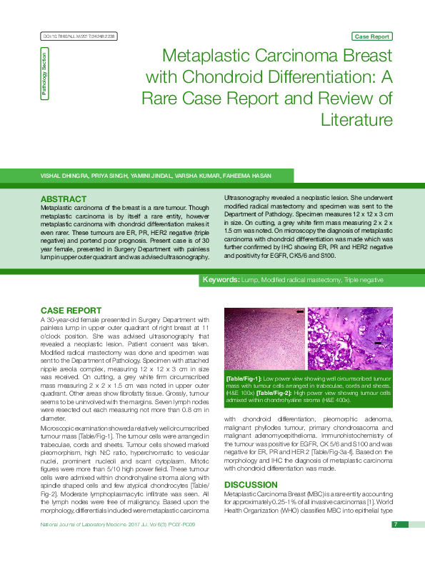 (PDF) Metaplastic Carcinoma Breast with Chondroid Differentiation: A ...