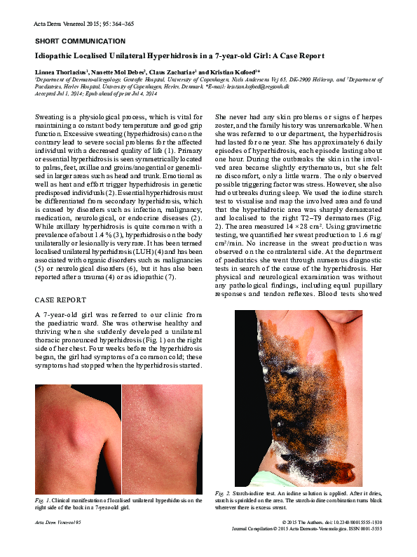 (PDF) Idiopathic Localised Unilateral Hyperhidrosis in a 7-year-old ...