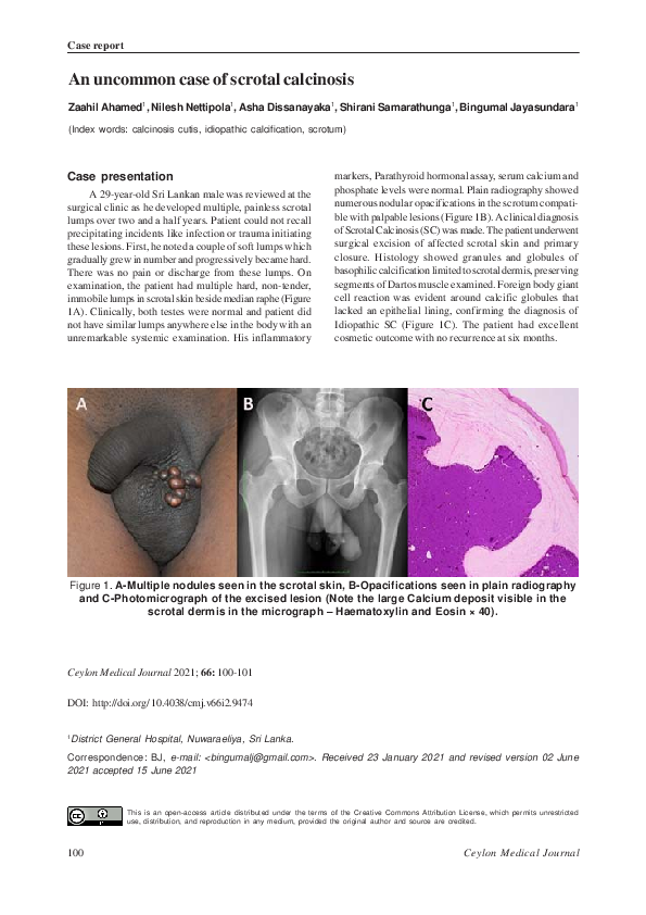 pdf-an-uncommon-case-of-scrotal-calcinosis