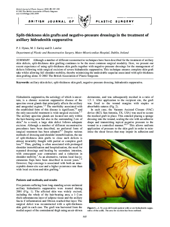 (PDF) Splitthickness skin grafts and negativepressure dressings in