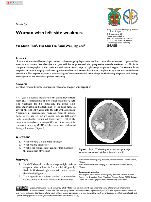 (PDF) Woman with left-side weakness