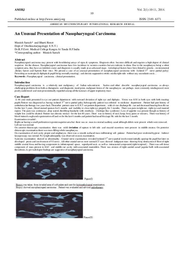 (PDF) An Unusual Presentation of Nasopharyngeal Carcinoma | DR MUNISH ...