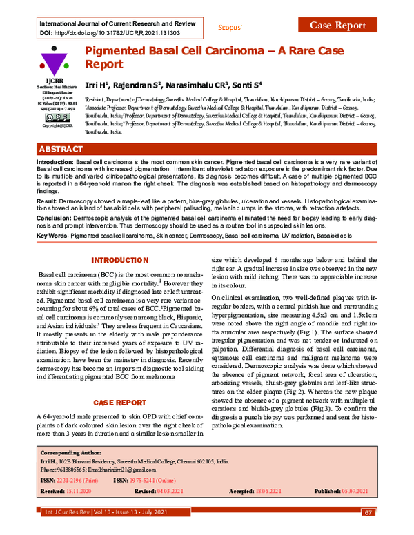 (PDF) Pigmented Basal Cell Carcinoma: A Rare Case Report