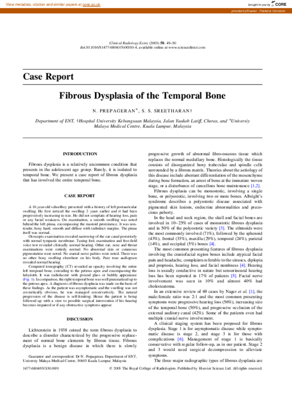 (PDF) Fibrous dysplasia of the temporal bone