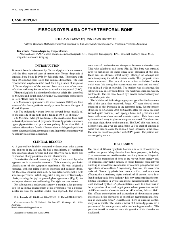 (PDF) Fibrous dysplasia of the temporal bone