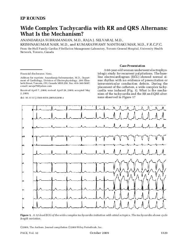(PDF) Wide Complex Tachycardia with RR and QRS Alternans: What Is the ...