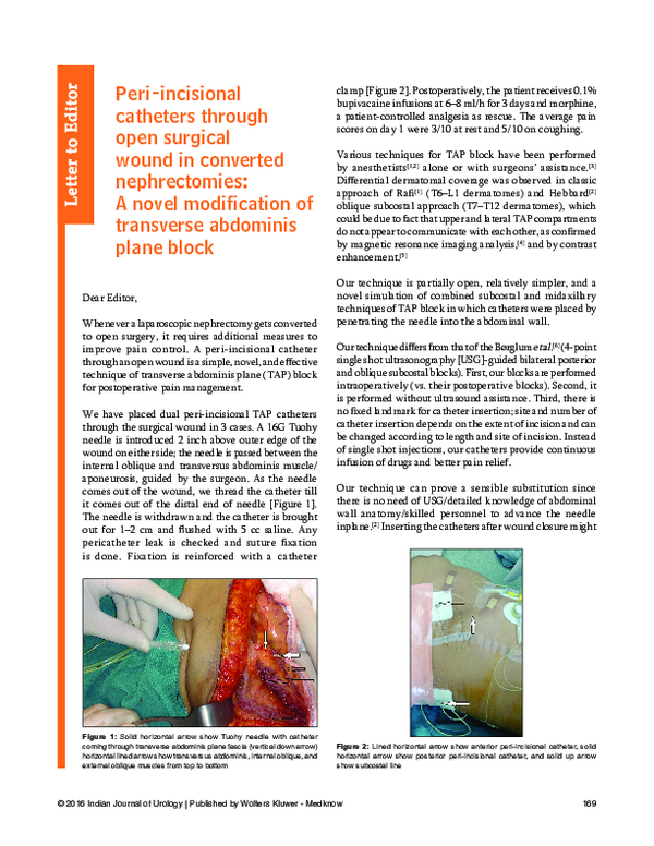 (PDF) Peri-incisional catheters through open surgical wound in ...