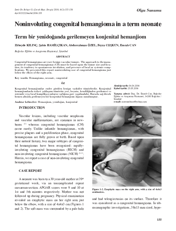 (PDF) Noninvoluting congenital hemangioma in a term neonate: Case report