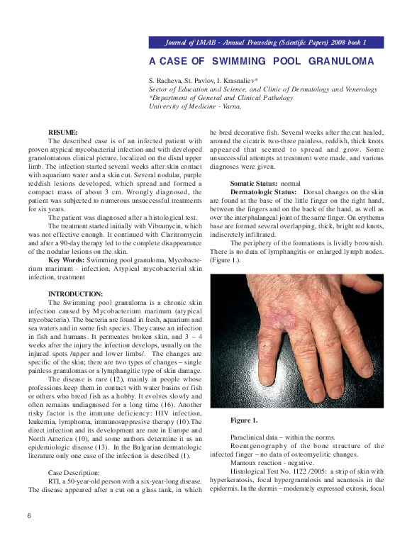 (PDF) 6A Case of Swimming Pool Granuloma I. Krasnaliev Academia.edu