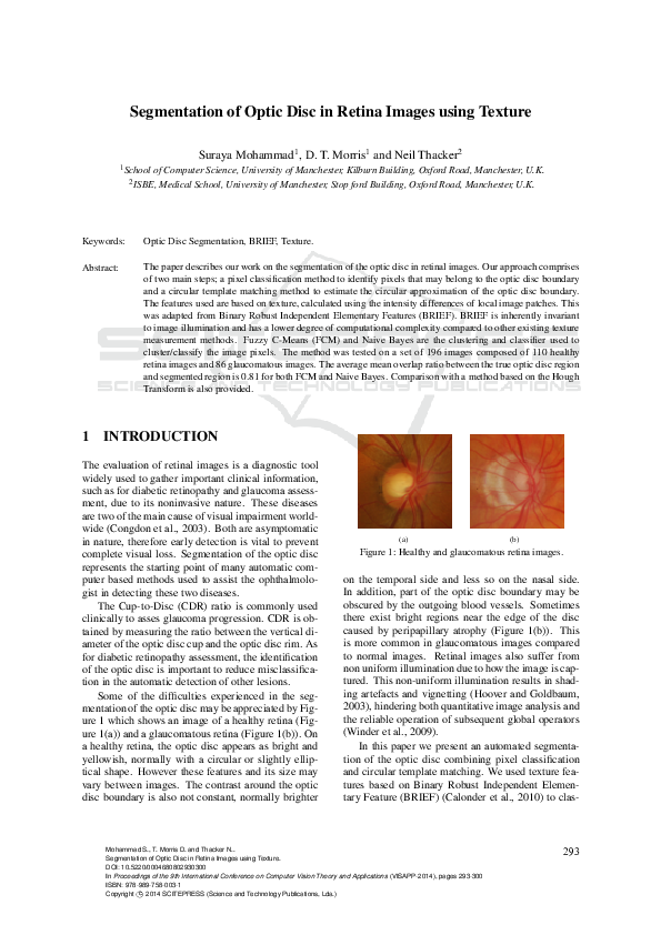 (PDF) Segmentation of optic disc in retina images using texture