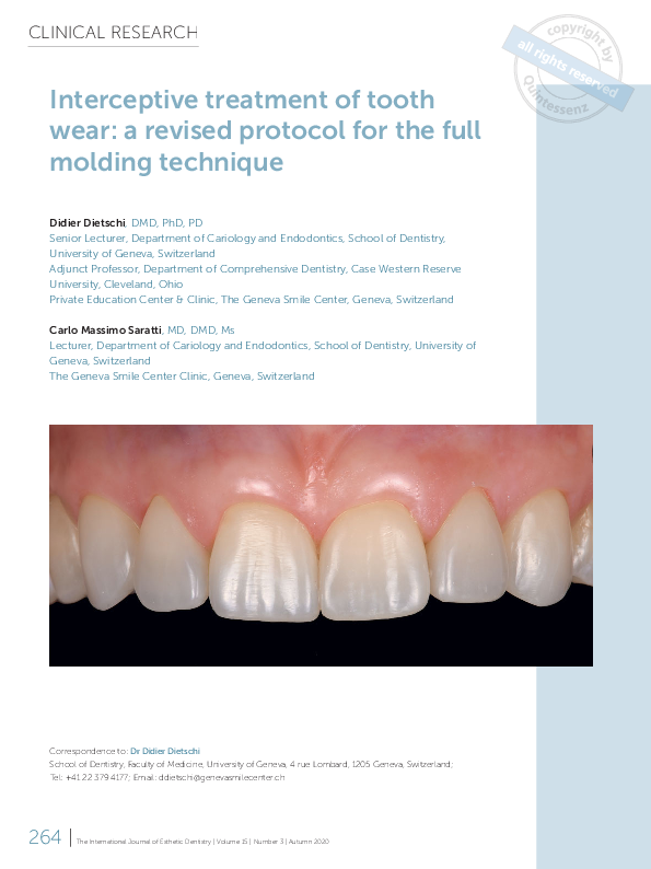 (PDF) Interceptive treatment of tooth wear a revised protocol for the