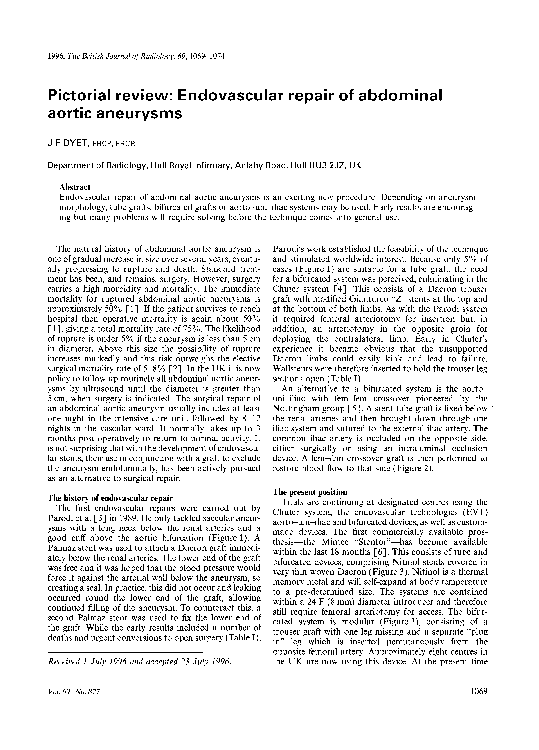 (PDF) Endovascular Repair of Abdominal Aortic Aneurysm