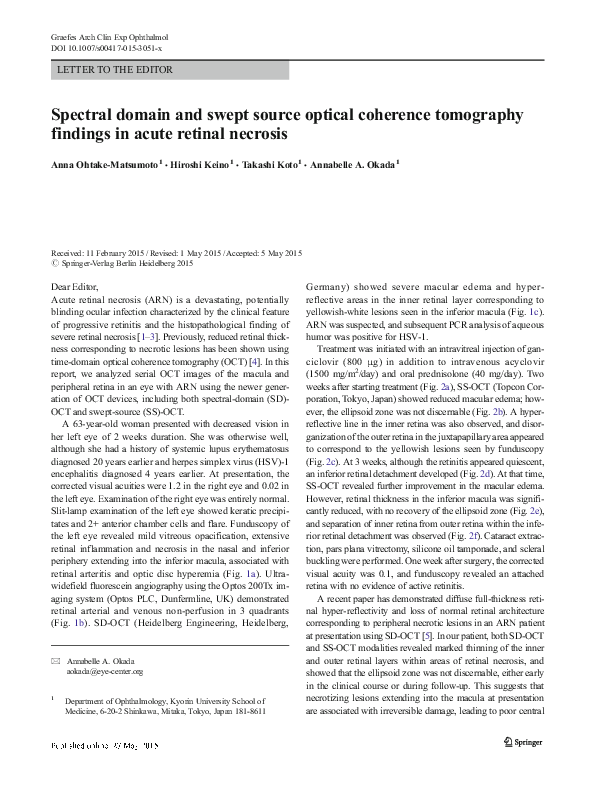 (PDF) Spectral domain and swept source optical coherence tomography on ...