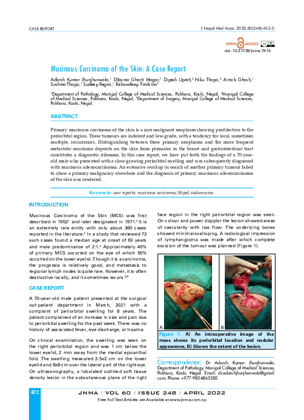 (PDF) Mucinous Carcinoma of the Skin: A Case Report