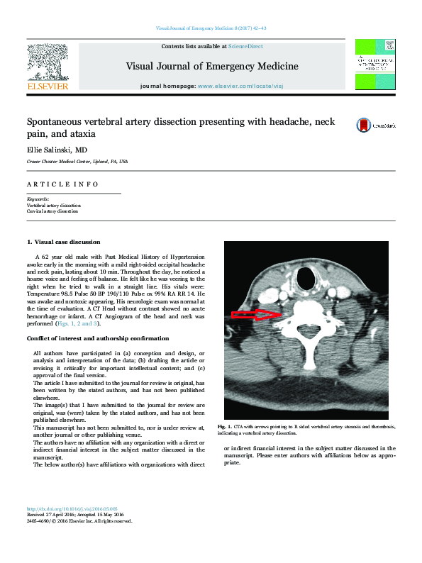 (PDF) Spontaneous vertebral artery dissection presenting with headache ...