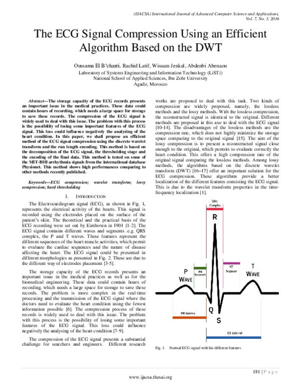 (PDF) The ECG Signal Compression Using an Efficient Algorithm Based on ...