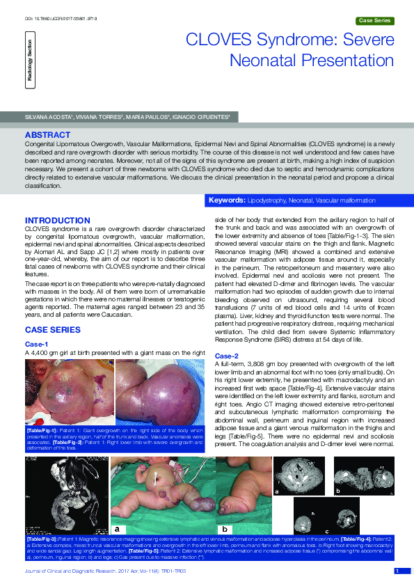 (PDF) CLOVES Syndrome Severe Neonatal Presentation silvana acosta