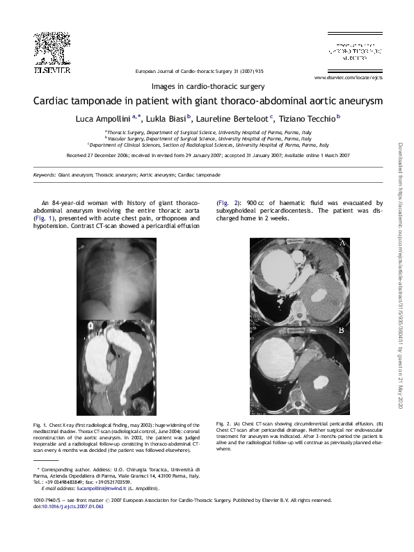 (PDF) Cardiac tamponade in patient with giant thoraco-abdominal aortic ...