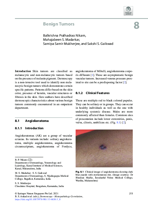 (PDF) Benign Tumors