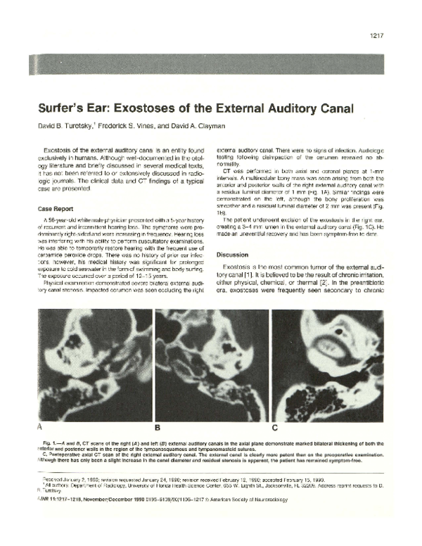 (PDF) Surfer's ear: exostoses of the external auditory canal