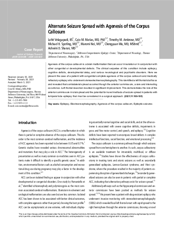 (PDF) Alternate Seizure Spread with Agenesis of the Corpus Callosum