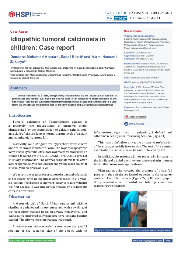 (PDF) Idiopathic tumoral calcinosis in children: Case report