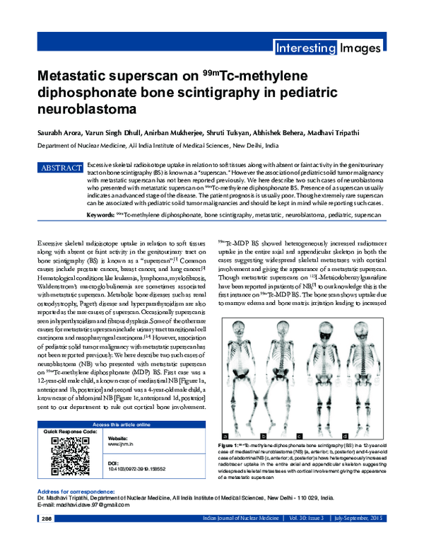 (PDF) Metastatic superscan on99mTc-methylene diphosphonate bone ...