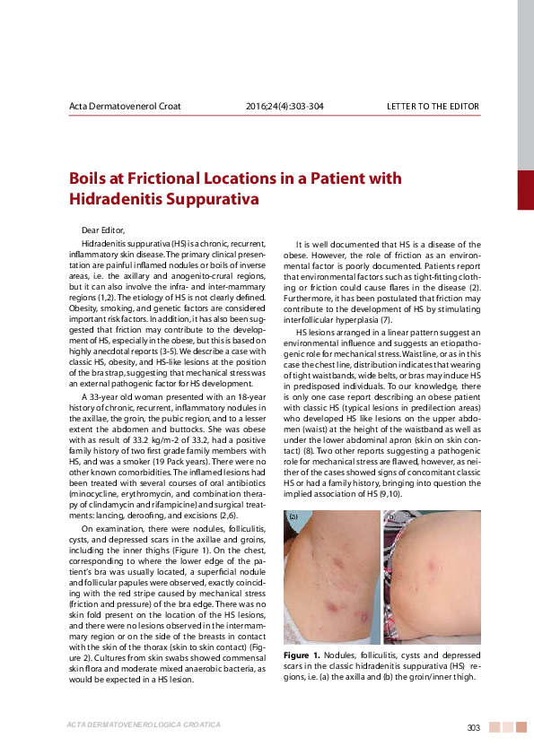 (PDF) Boils at Frictional Locations in a Patient with Hidradenitis