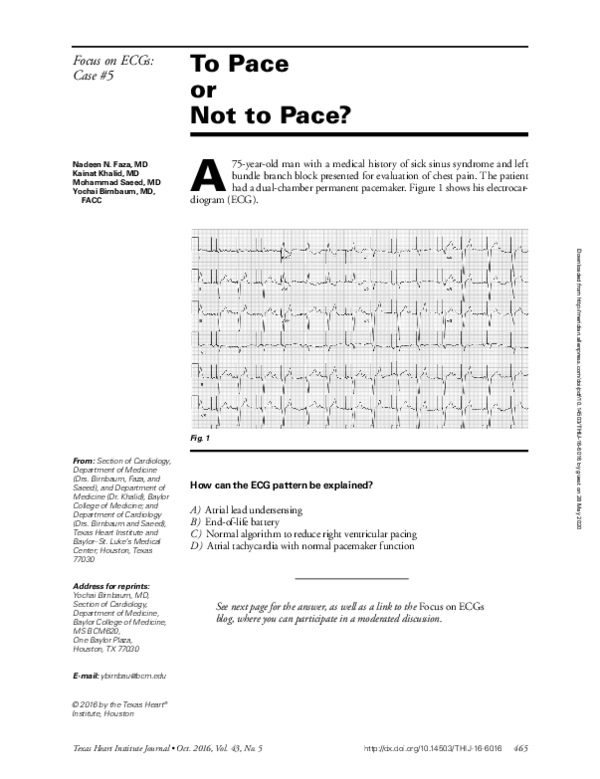 (PDF) To Pace or Not to Pace?
