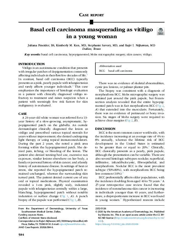 (PDF) Basal cell carcinoma masquerading as vitiligo in a young woman