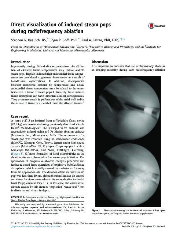 (PDF) Direct Visualization of Induced Steam Pops during Radiofrequency ...