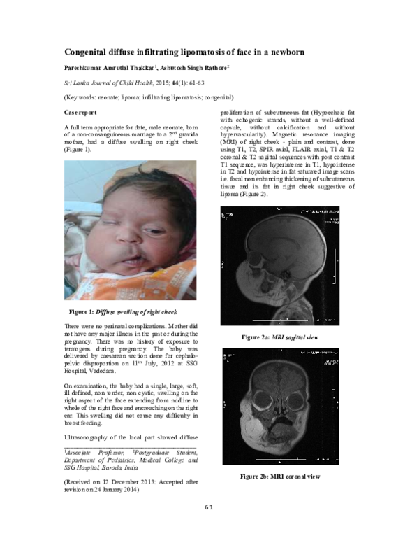 (PDF) Congenital diffuse infiltrating lipomatosis of face in a newborn ...