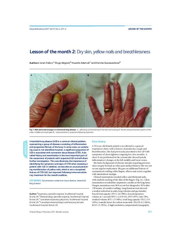 (PDF) Lesson of the month 2: Dry skin, yellow nails and breathlessness