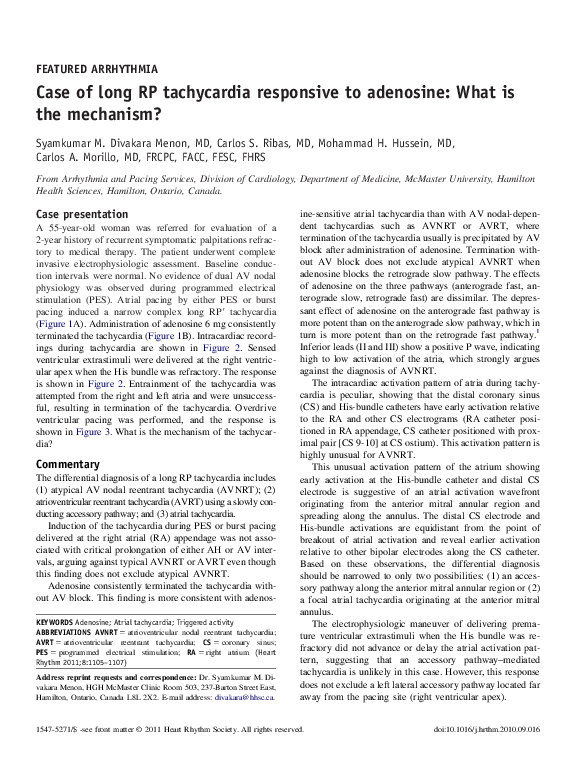 (PDF) Case of long RP tachycardia responsive to adenosine: What is the ...