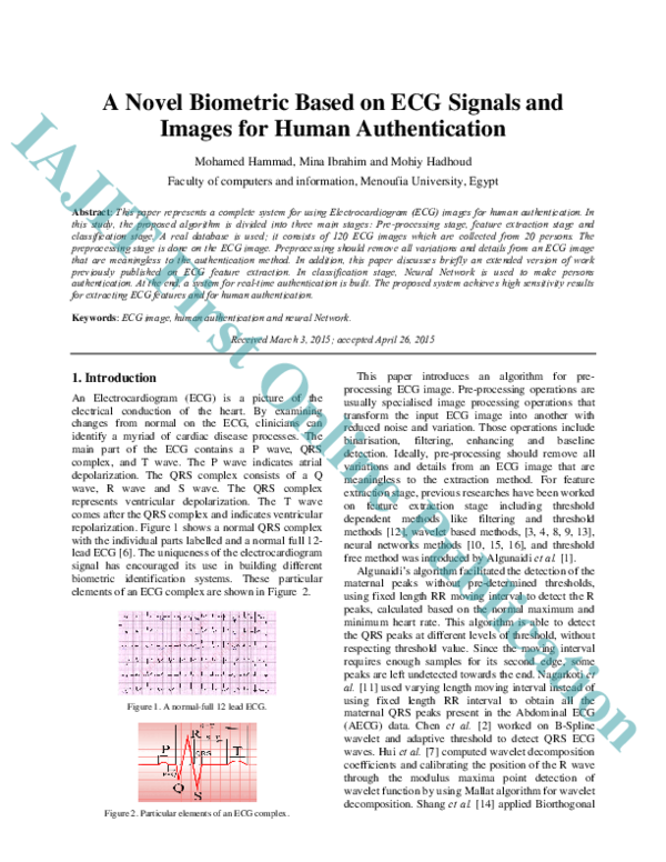 (PDF) A Novel Biometric Based on ECG Signals and Images for Human ...