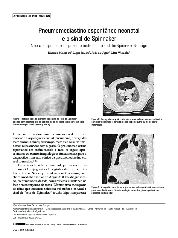 (PDF) Neonatal spontaneous pneumomediastinum and the Spinnaker-Sail ...