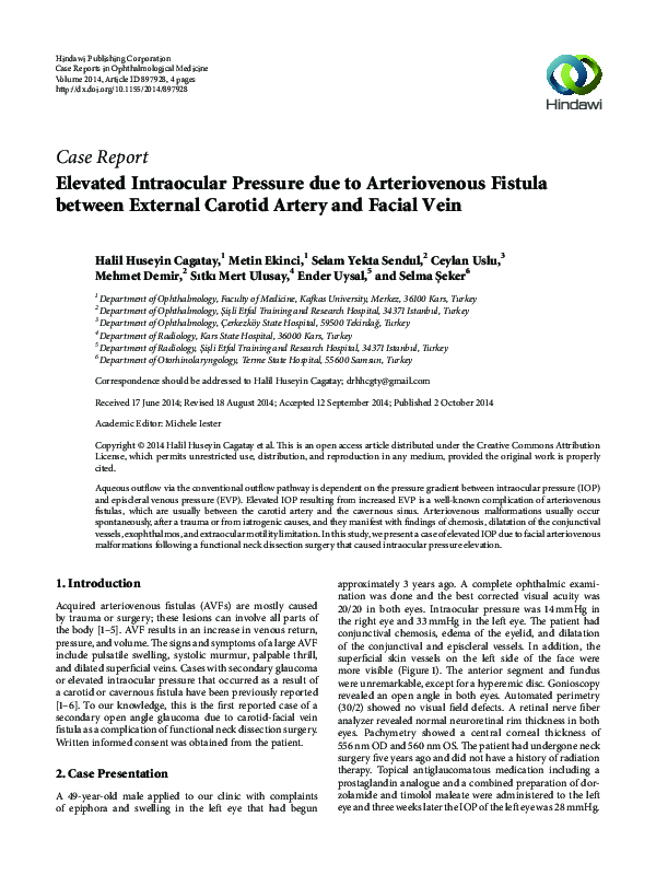 (PDF) Elevated Intraocular Pressure due to Arteriovenous Fistula