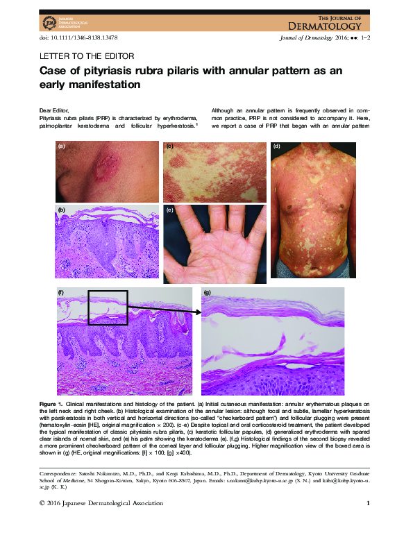 (PDF) Case of pityriasis rubra pilaris with annular pattern as an early ...