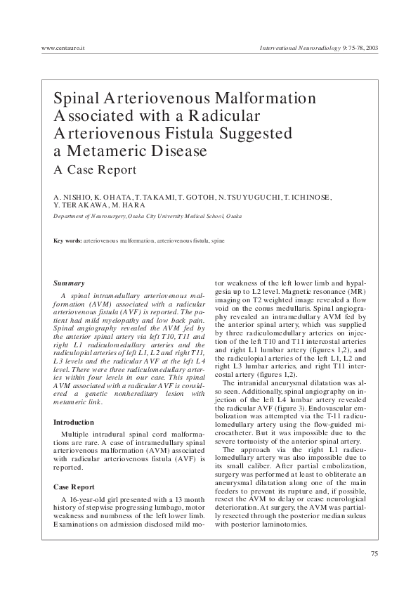 (PDF) Spinal arteriovenous malformation associated with syringomyelia