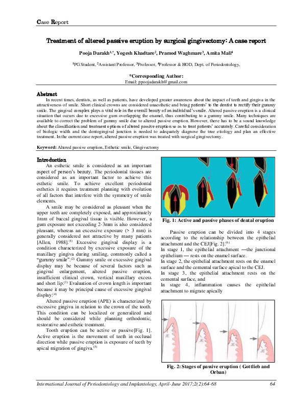 (PDF) Treatment of altered passive eruption by surgical gingivectomy A