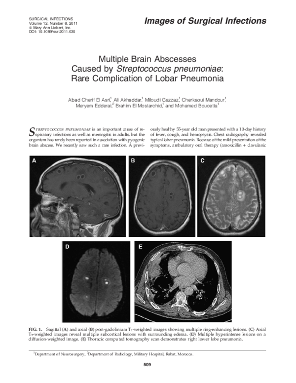 (PDF) Multiple brain abscesses caused by Streptococcus bovis