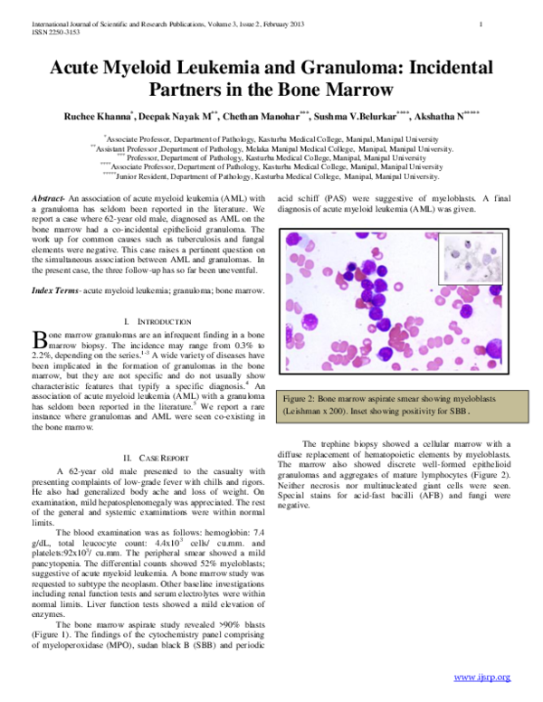 (PDF) Acute Myeloid Leukemia and Granuloma: Incidental Partners in the ...