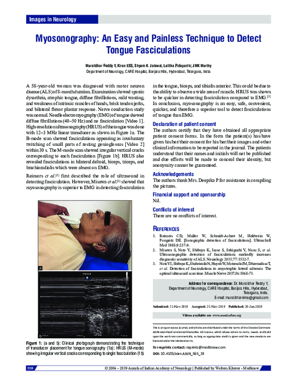 (PDF) Myosonography An easy and painless technique to detect tongue fasciculations Shyam