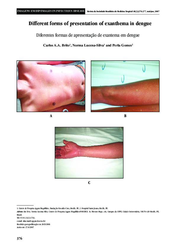 (PDF) Different forms of presentation of exanthema in dengue