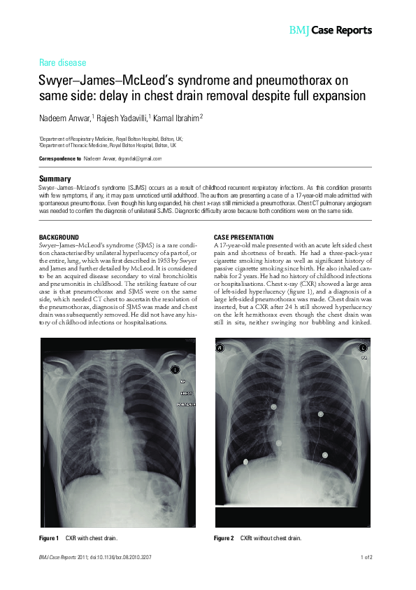 (PDF) Swyer-James-McLeod's syndrome and pneumothorax on same side ...