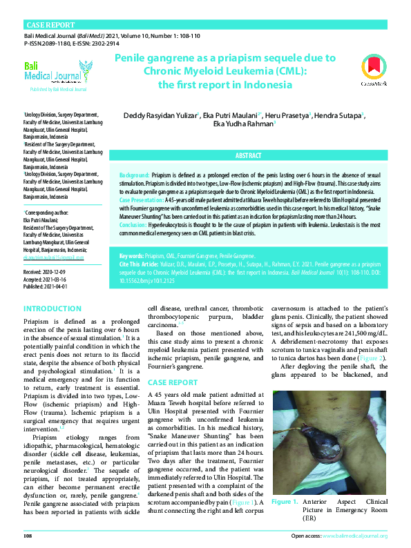 melanotan 2 patches Melanotan II Safety: Tanning Injection