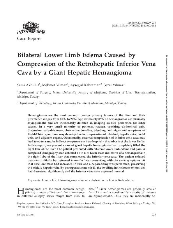 (PDF) Bilateral Lower Limb Edema Caused by Compression of the ...
